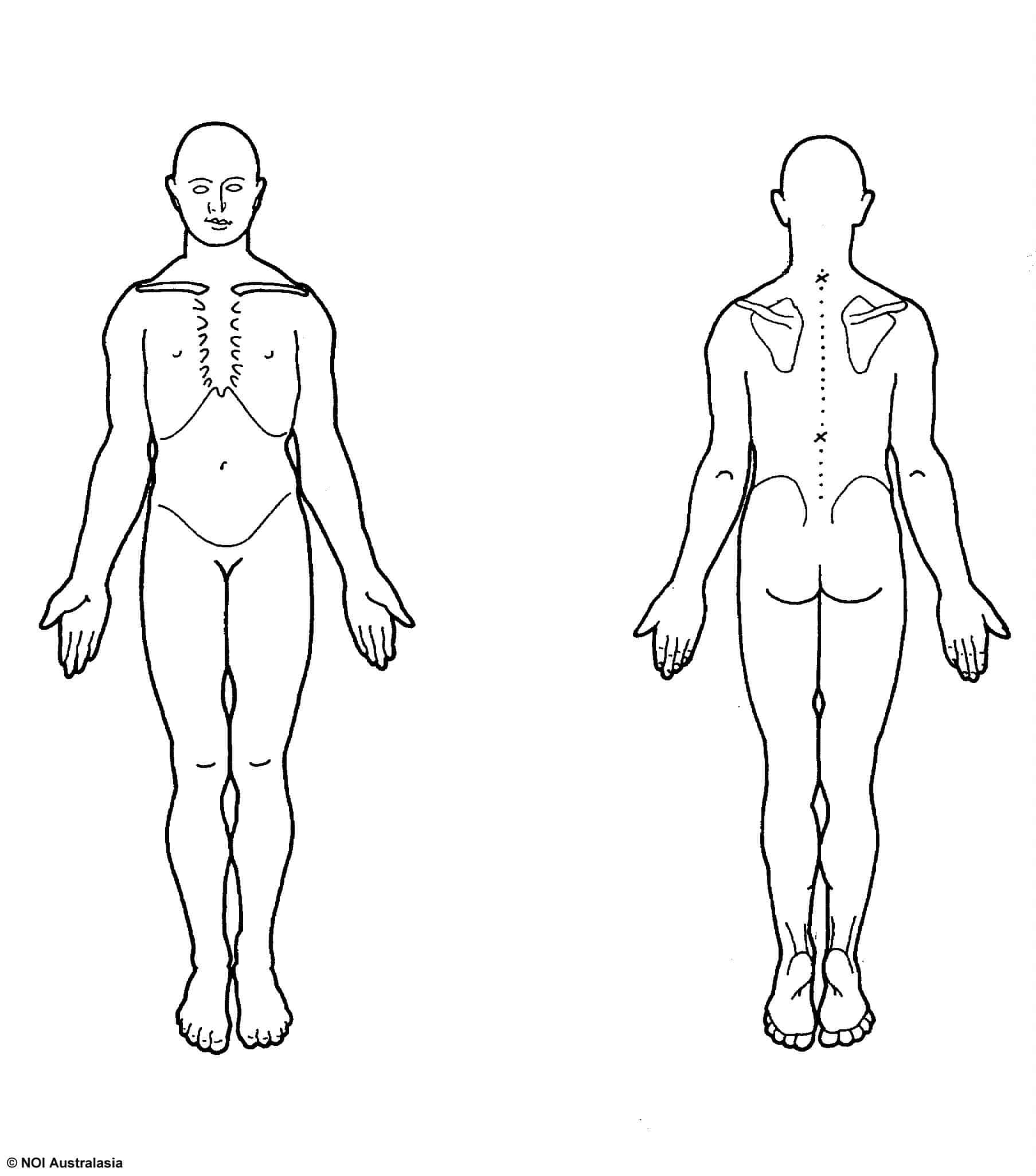 Body chart Weymouth Physiotherapy